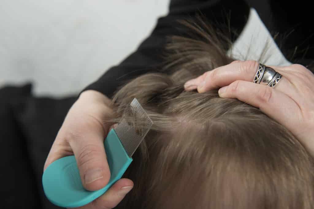 How the Pandemic Has Affected Head Lice Outbreaks and 3 Useful Tips to Help You Prepare - BC Parent Newsmagazine