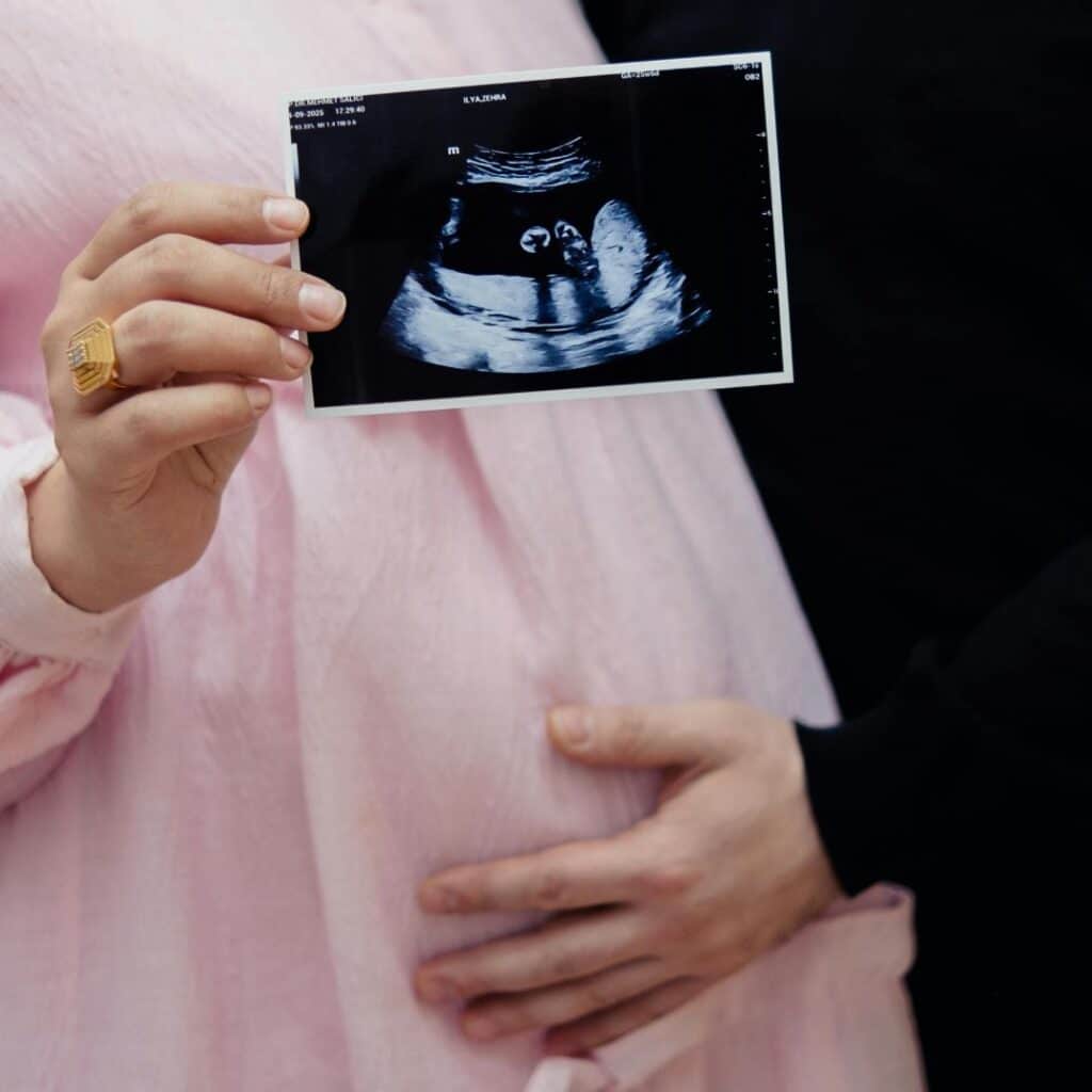 Cesarean, Pregnant couple holding ultrasound photo