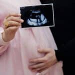 Cesarean, Pregnant couple holding ultrasound photo